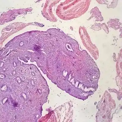 Picture for song 'Ego (feat. Jane Severi)' by artist 'EH?'