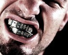 Picture for song 'Ice Grillz **FREE DOWNLOAD**' by artist 'Hood Legends Beats'