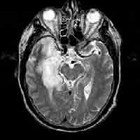 Picture for song 'Cerebral Damage' by artist 'The Spooge'