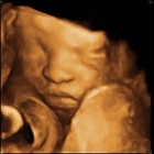 Picture for song 'I'LL BE HERE Ft. John Micheal**NEW**Free Download*' by artist 'ARKEYLEIUS'