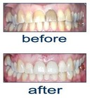 Picture for song 'the way live you smile at me (heavy version)' by artist 'RICKY RAVEN AND THE JACKDAWS'