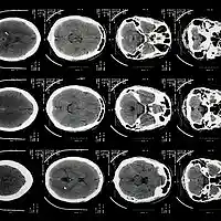 Picture for song 'All Black' by artist 'Jeremy Heights'