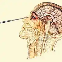 Picture for song 'Lobotomy' by artist 'XL73'