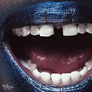 Picture for song 'Cooties' by artist 'Eldar-Q'