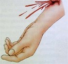 Picture for song 'I Bleed feat. Chelsea' by artist 'One Kingdom'