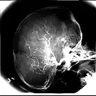 Picture for song 'fedup' by artist 'Resinate'