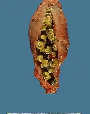 Picture for song 'galblaas' by artist 'energyboys'