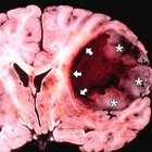 Picture for song 'The Last Phase Of A Mental Breakdown' by artist 'Iphorill'