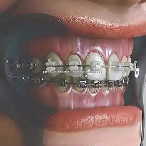 Picture for song 'DON'T MOVE YOUR MONTH' by artist 'FILEV'