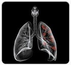 Picture for song 'Perforated Lungs' by artist 'DJ Happy Lucky Golden Dragon'