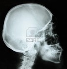 Picture for song 'Lose My Mind' by artist 'Drupz'