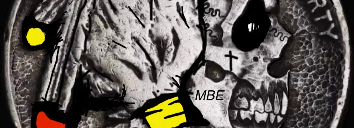 cover pic