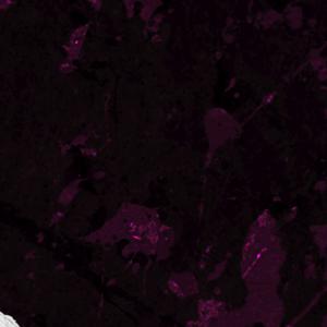 Picture for song 'Easy (Lil Tecca Type Beat)' by artist 'Xpensive'