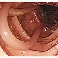 Picture for song 'Glory Half' by artist 'JimRoss'